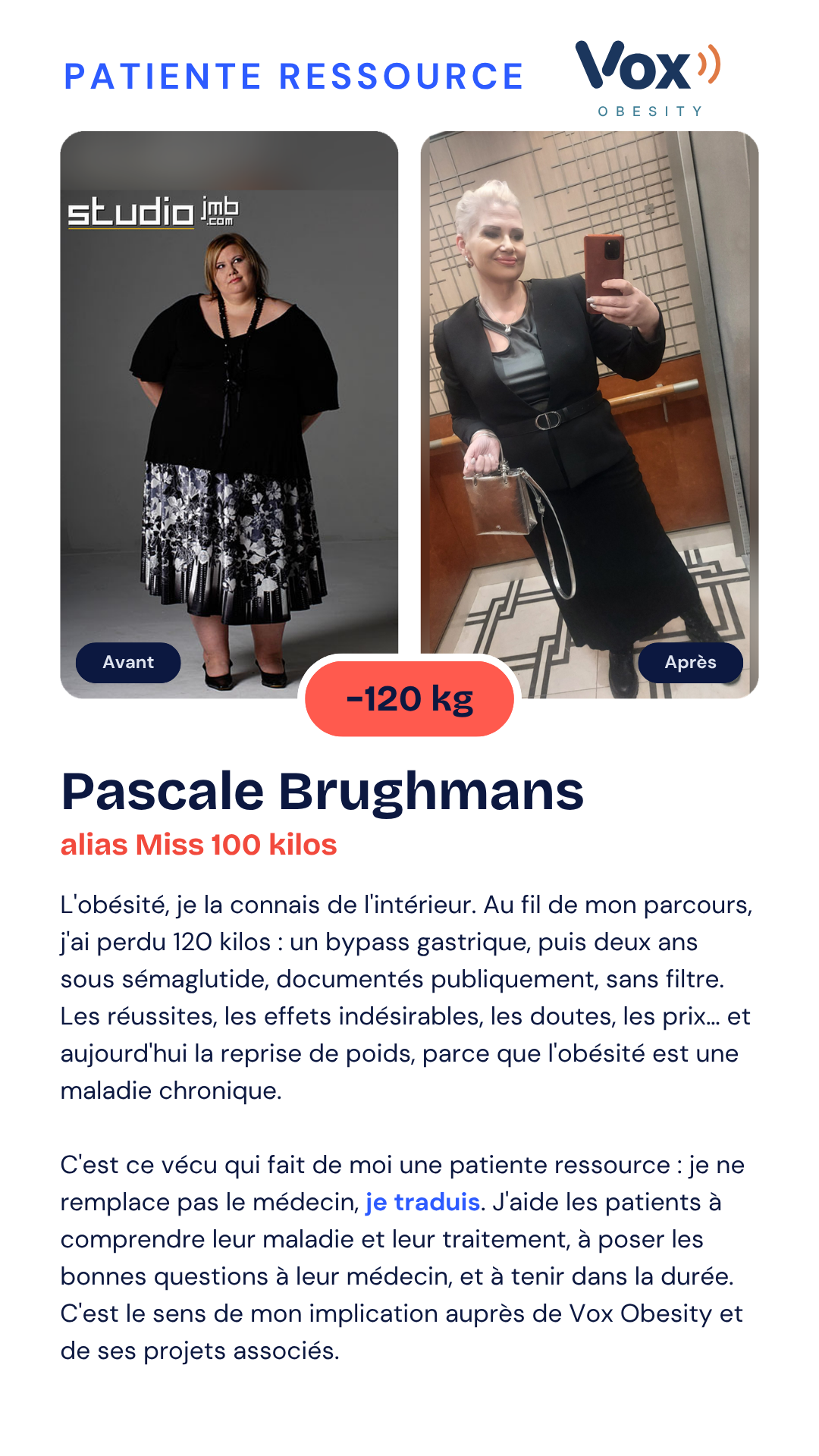 Pascale Brughmans, alias Miss 100 kilos, patiente ressource Vox Obesity, avant et après une perte de 120 kg
